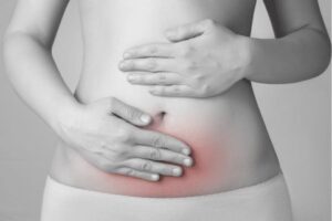 Can CBD Relieve the Anguish & Torment of Endometriosis? 2